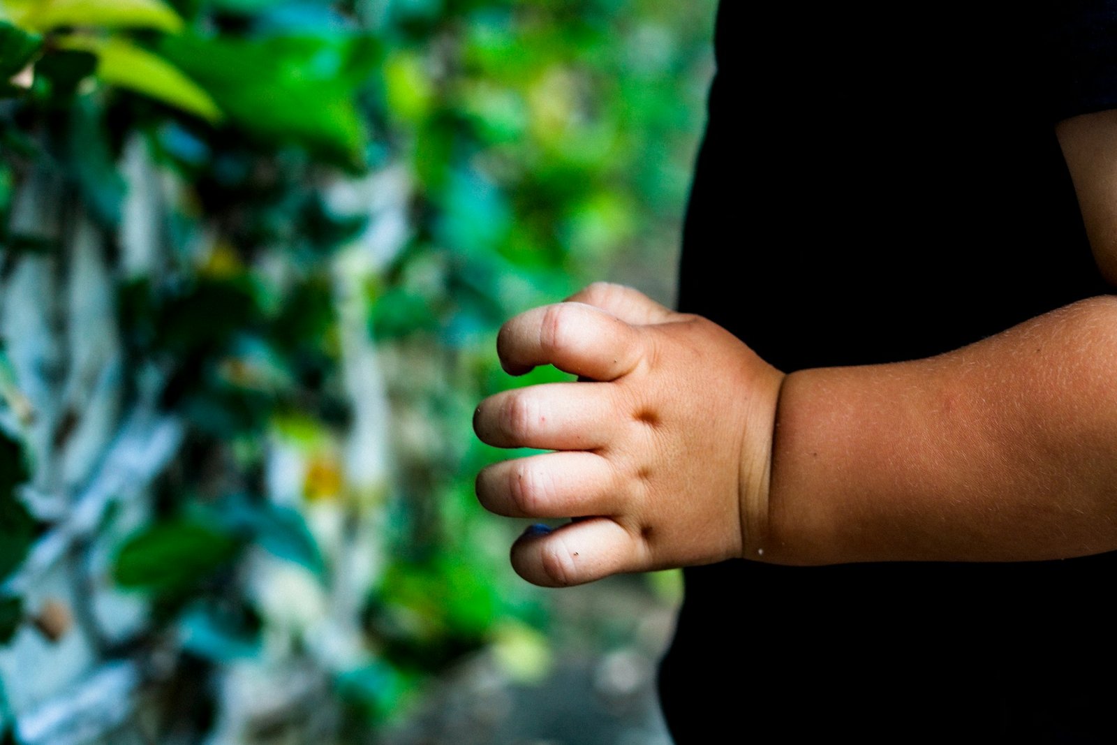 Childhood morbid obesity: importance of awareness - Image